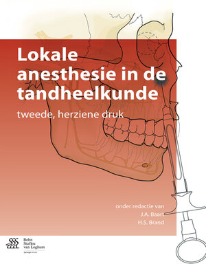 cover image of Lokale anesthesie in de tandheelkunde
